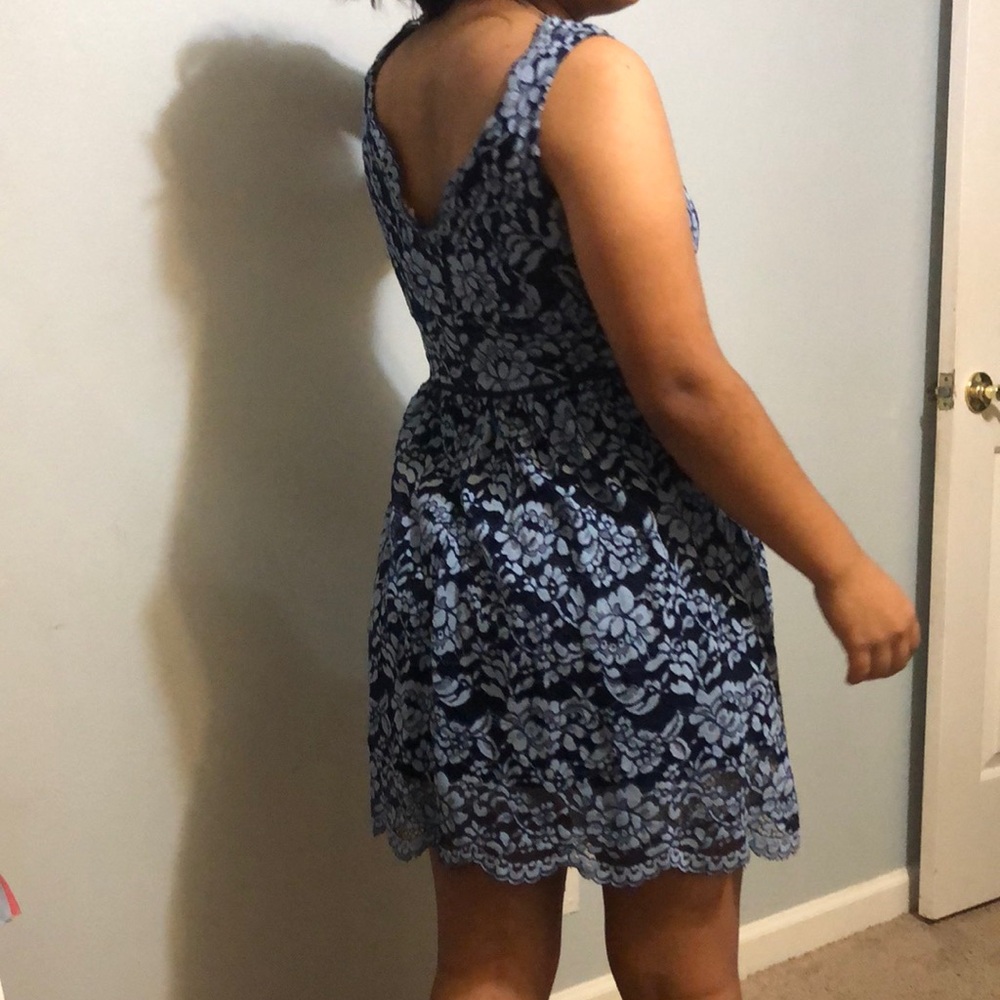 Elegant Blue Lace Dress